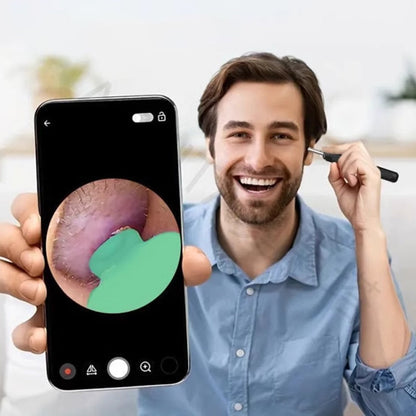 Herramienta de Eliminación de Cerumen con Cámara y Luz