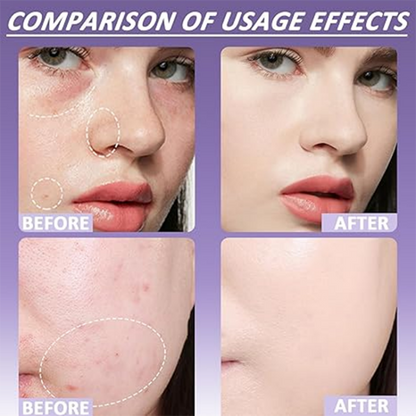Corrector Mate para Rostro y Cuerpo